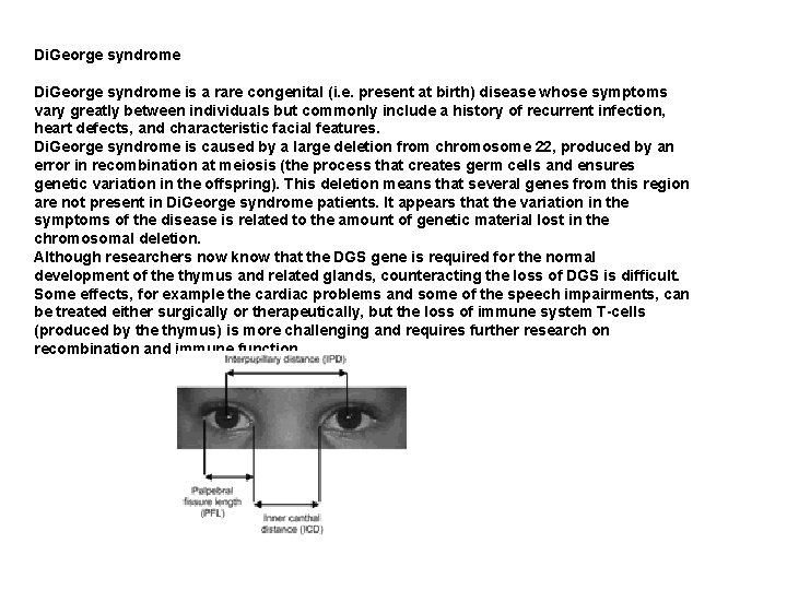 Di. George syndrome is a rare congenital (i. e. present at birth) disease whose