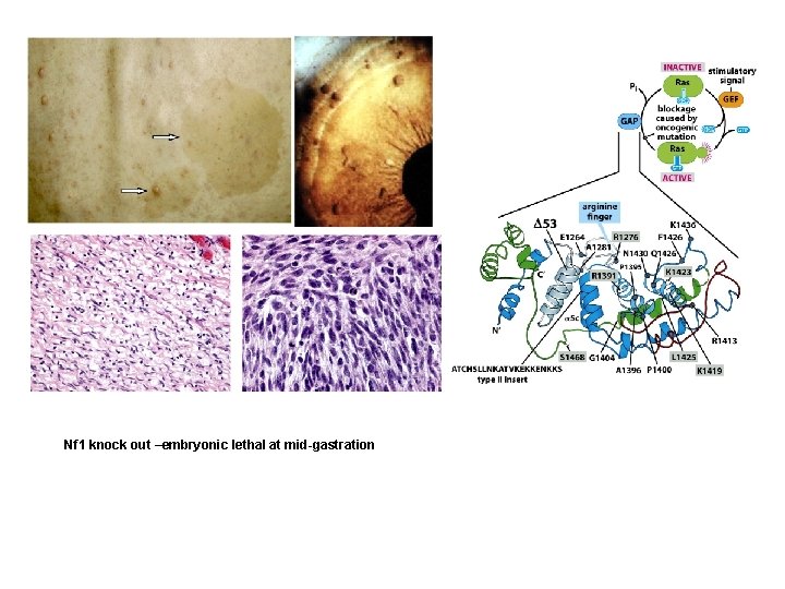 Nf 1 knock out –embryonic lethal at mid-gastration 