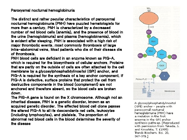 Paroxysmal nocturnal hemoglobinuria The distinct and rather peculiar characteristics of paroxysmal nocturnal hemoglobinuria (PNH)