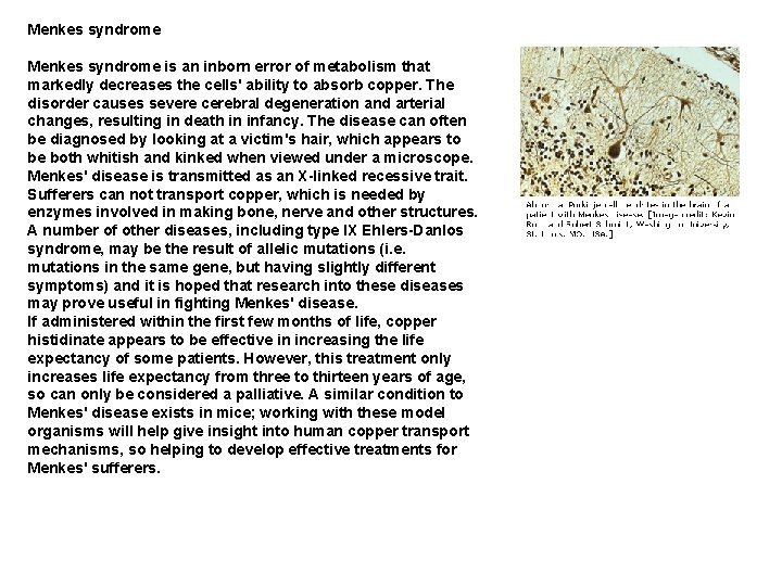 Menkes syndrome is an inborn error of metabolism that markedly decreases the cells' ability