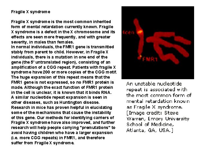 Fragile X syndrome is the most common inherited form of mental retardation currently known.