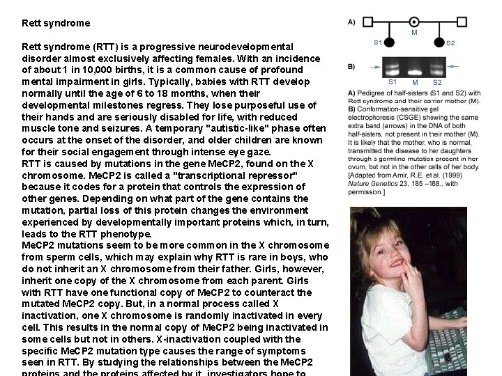 Rett syndrome (RTT) is a progressive neurodevelopmental disorder almost exclusively affecting females. With an