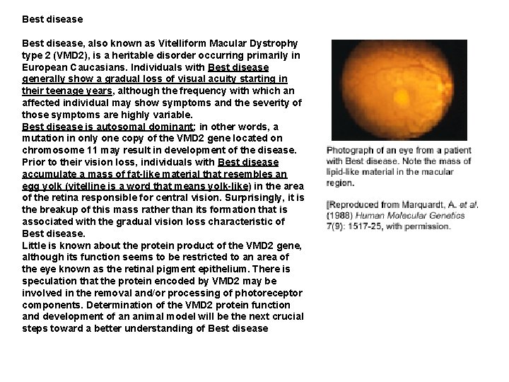 Best disease Best disease, also known as Vitelliform Macular Dystrophy type 2 (VMD 2),