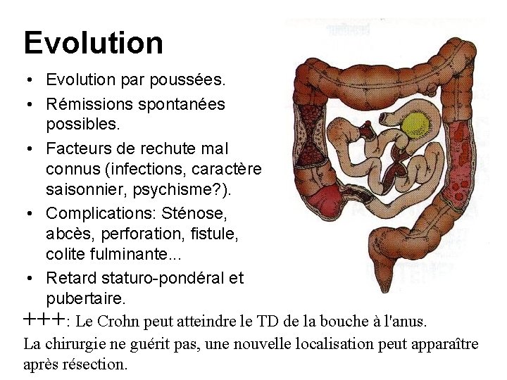 Evolution • Evolution par poussées. • Rémissions spontanées possibles. • Facteurs de rechute mal