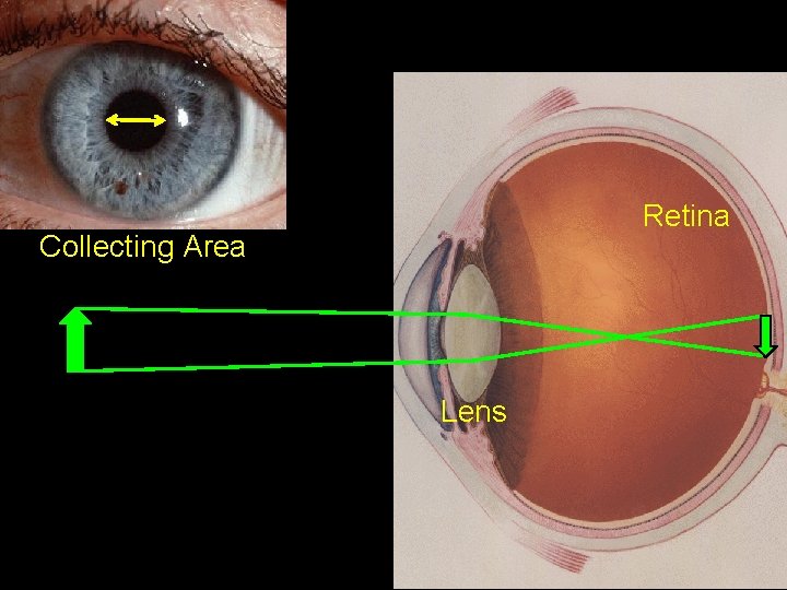 Retina Collecting Area Lens 