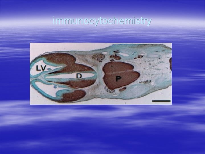 immunocytochemistry 