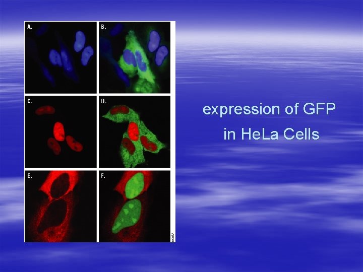 expression of GFP in He. La Cells 