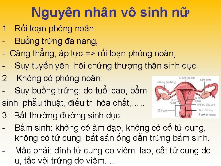 Nguyên nhân vô sinh nữ 1. Rối loạn phóng noãn: - Buồng trứng đa