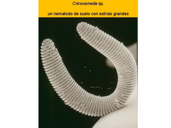 Criconemella sp. un nematodo de suelo con estrías grandes 