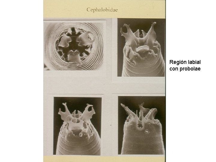 Región labial con probolae 
