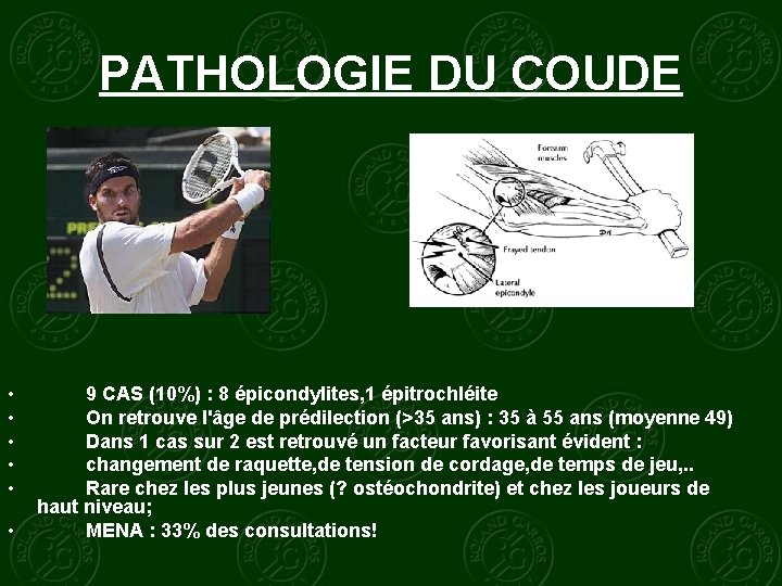 PATHOLOGIE DU COUDE • • • 9 CAS (10%) : 8 épicondylites, 1 épitrochléite