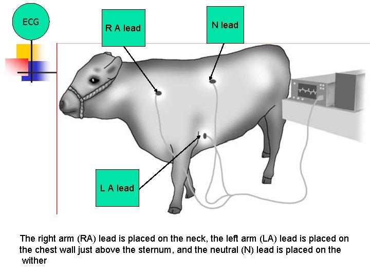 ECG R A lead N lead L A lead The right arm (RA) lead
