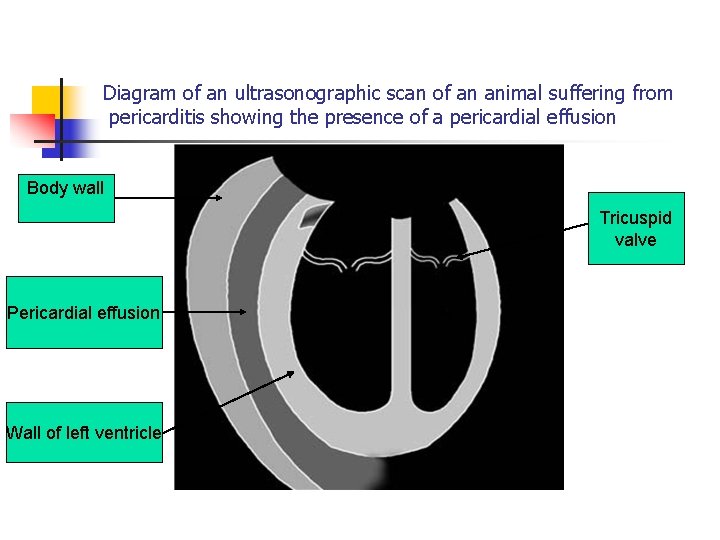Diagram of an ultrasonographic scan of an animal suffering from pericarditis showing the presence
