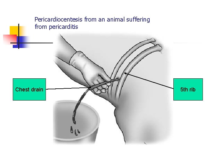 Pericardiocentesis from an animal suffering from pericarditis Chest drain 5 th rib 