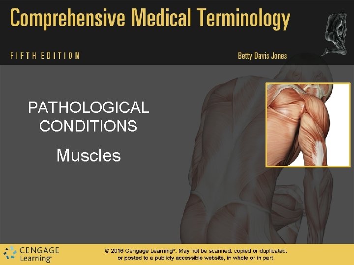 PATHOLOGICAL CONDITIONS Muscles PATHOLOGICAL CONDITIONS Muscles