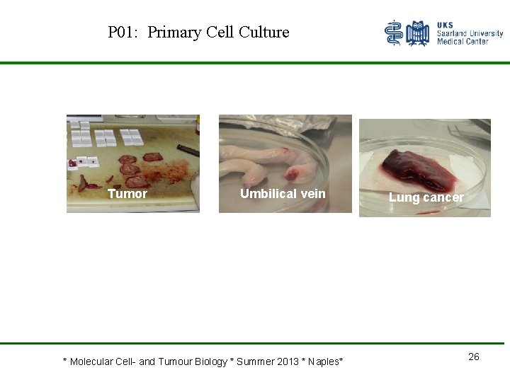 P 01: Primary Cell Culture Tumor Umbilical vein * Molecular Cell- and Tumour Biology