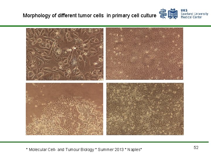 Morphology of different tumor cells in primary cell culture * Molecular Cell- and Tumour