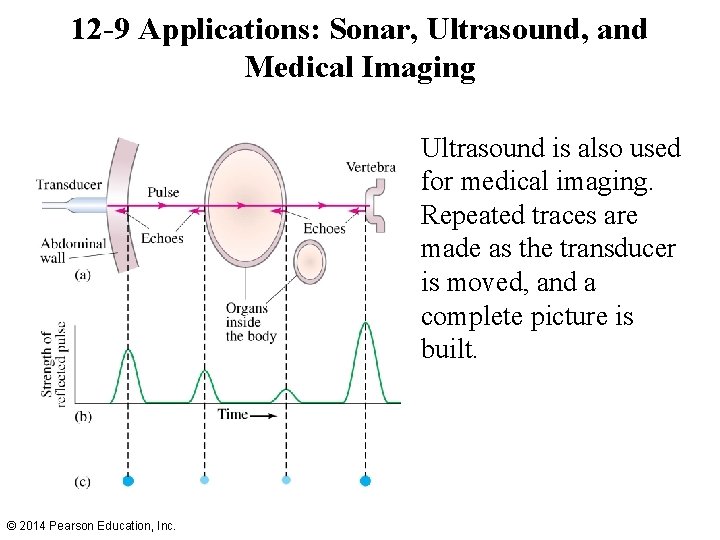 12 -9 Applications: Sonar, Ultrasound, and Medical Imaging Ultrasound is also used for medical