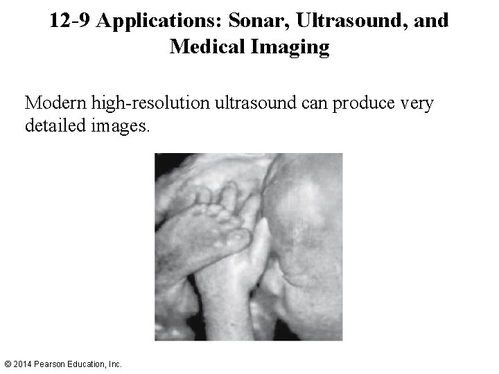 12 -9 Applications: Sonar, Ultrasound, and Medical Imaging Modern high-resolution ultrasound can produce very