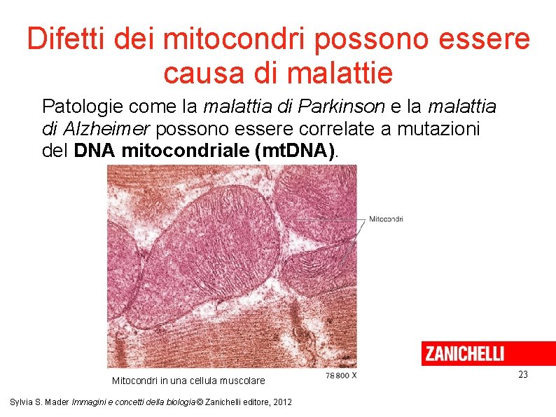 Difetti dei mitocondri possono essere causa di malattie Patologie come la malattia di Parkinson Difetti dei mitocondri possono essere causa di malattie Patologie come la malattia di Parkinson
