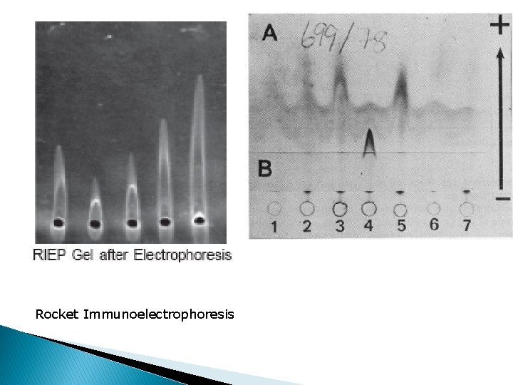 Rocket Immunoelectrophoresis 