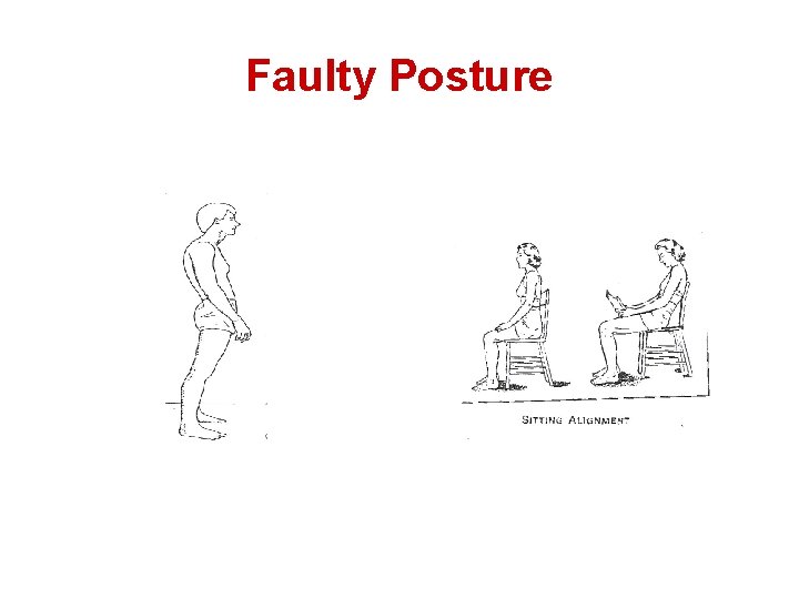 Faulty Posture 