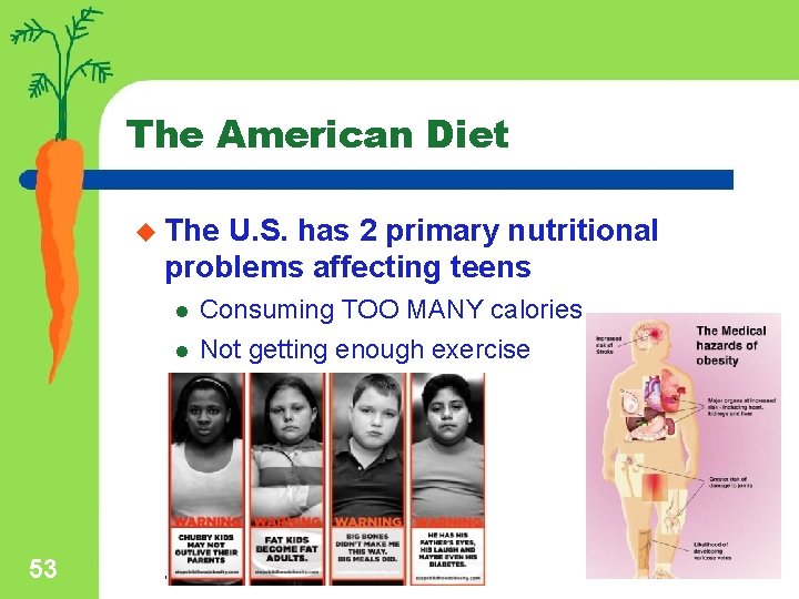 The American Diet u The U. S. has 2 primary nutritional problems affecting teens