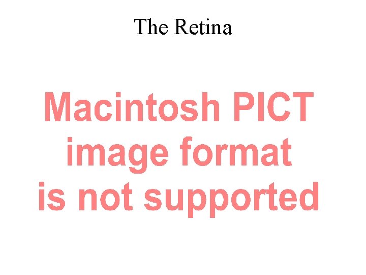 The Retina 