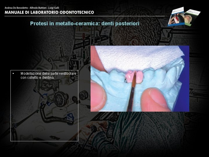 Protesi in metallo-ceramica: denti posteriori • Modellazione della parte vestibolare con colletto e dentina.