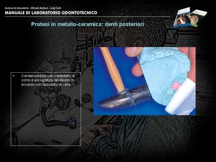 Protesi in metallo-ceramica: denti posteriori • Condensazione con martelletto di corno e asciugatura del