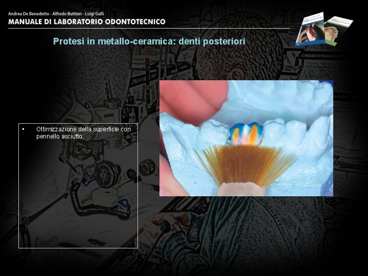 Protesi in metallo-ceramica: denti posteriori • Ottimizzazione della superficie con pennello asciutto. 20 
