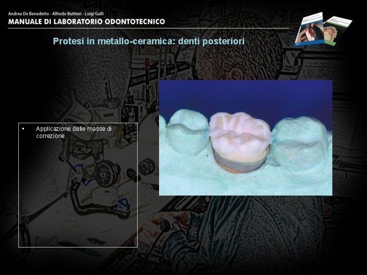 Protesi in metallo-ceramica: denti posteriori • Applicazione delle masse di correzione. 27 