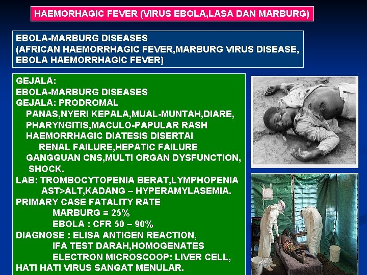 HAEMORHAGIC FEVER (VIRUS EBOLA, LASA DAN MARBURG) EBOLA-MARBURG DISEASES (AFRICAN HAEMORRHAGIC FEVER, MARBURG VIRUS