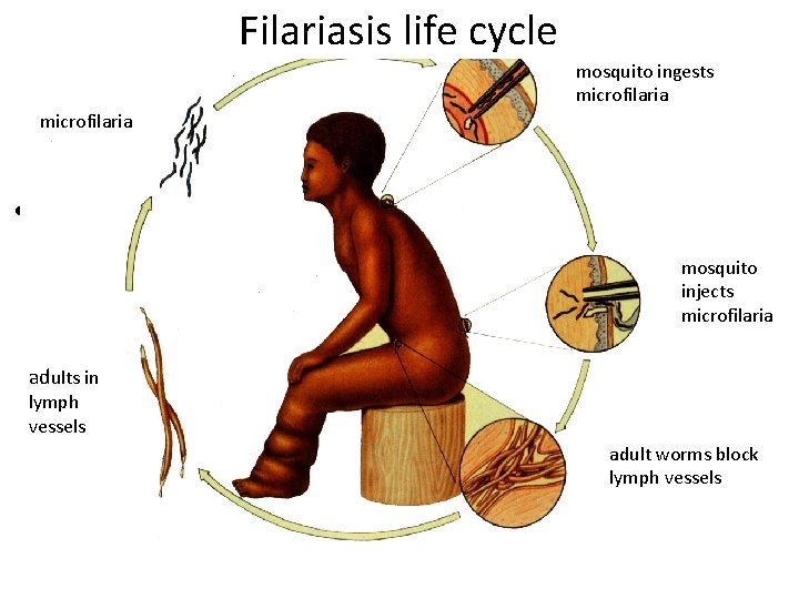 Filariasis life cycle mosquito ingests microfilaria • mosquito injects microfilaria adults in lymph vessels