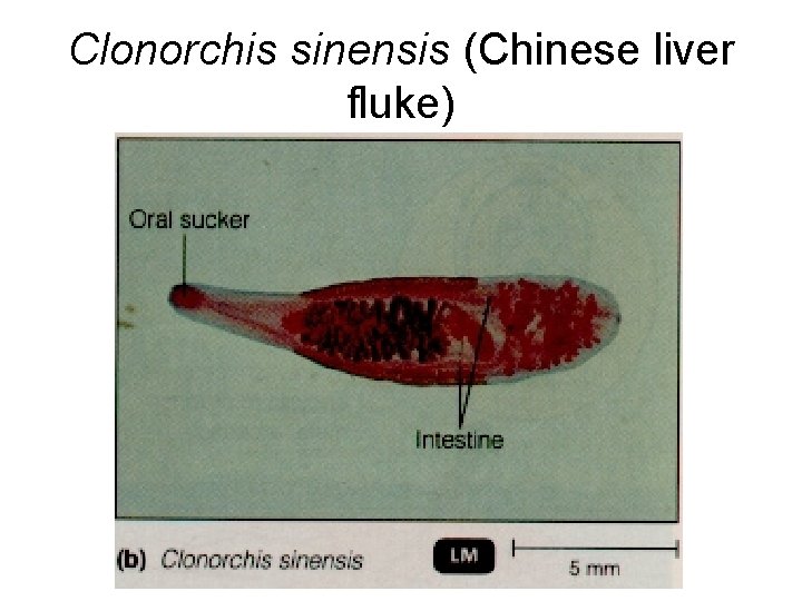 Clonorchis sinensis (Chinese liver fluke) 