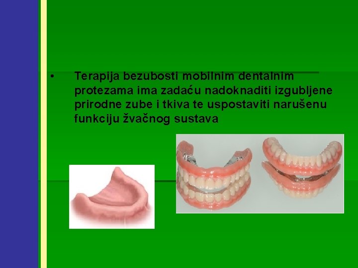  • Terapija bezubosti mobilnim dentalnim protezama ima zadaću nadoknaditi izgubljene prirodne zube i