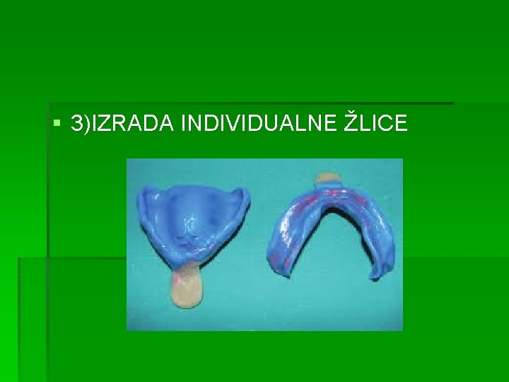 § 3)IZRADA INDIVIDUALNE ŽLICE 