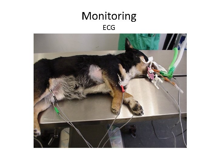Monitoring ECG 