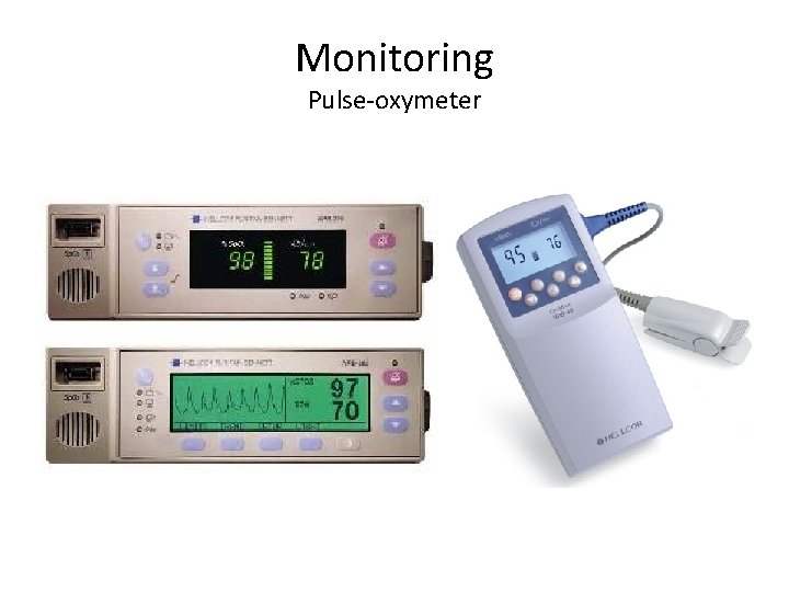 Monitoring Pulse-oxymeter 