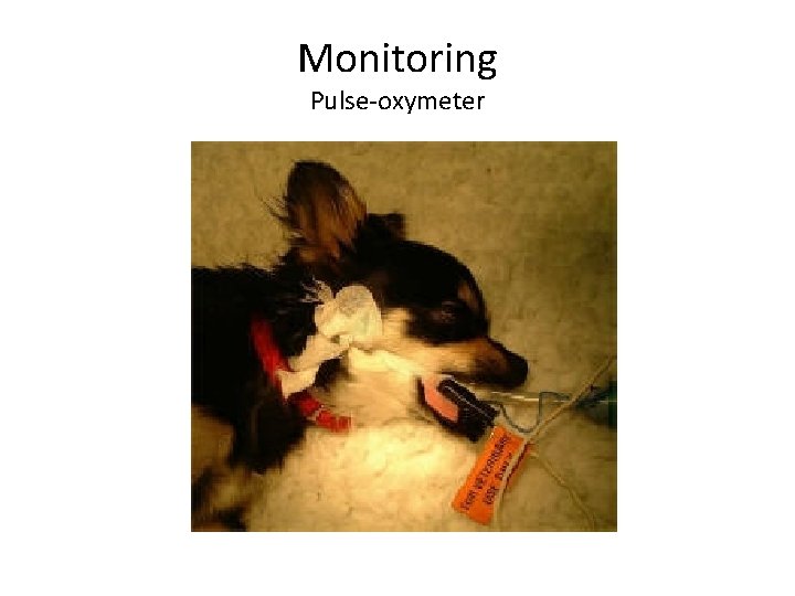 Monitoring Pulse-oxymeter 