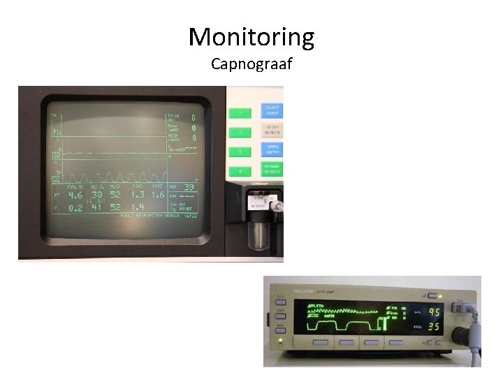 Monitoring Capnograaf 