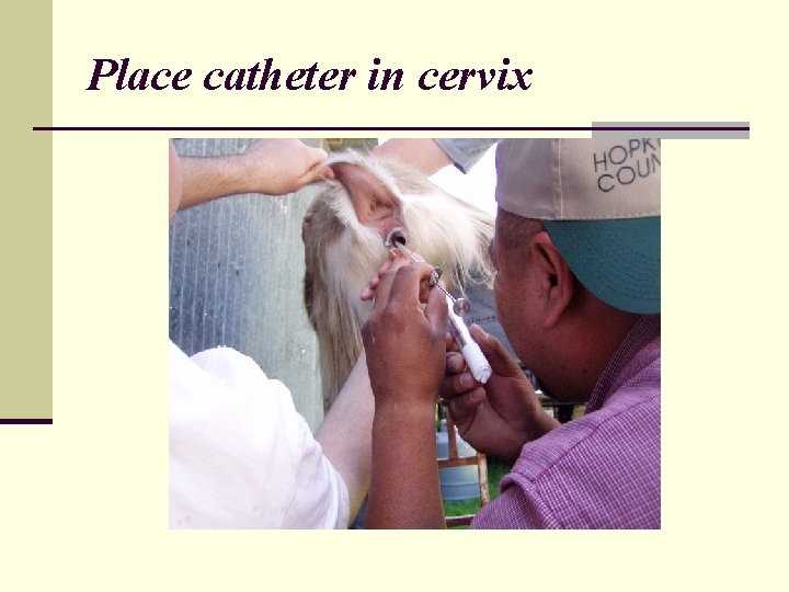 Place catheter in cervix 