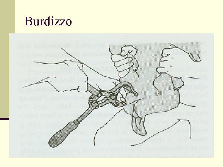 Burdizzo 