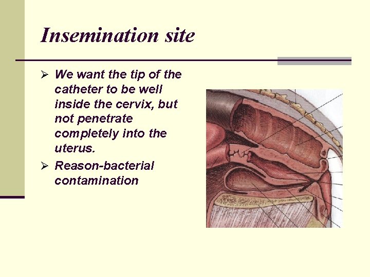 Insemination site Ø We want the tip of the catheter to be well inside