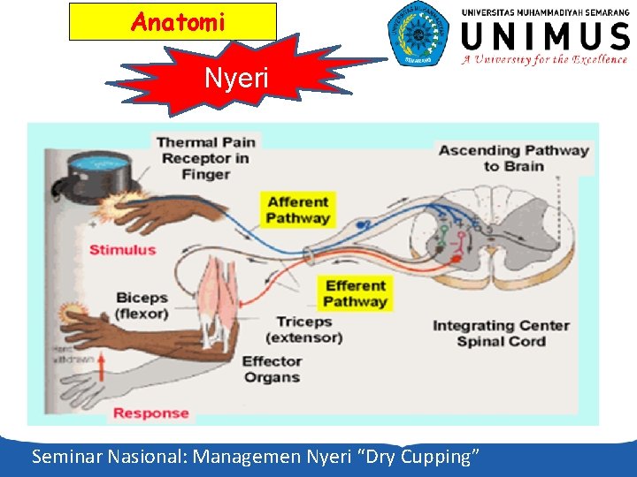 Anatomi Nyeri Seminar Nasional: Managemen Nyeri “Dry Cupping” 