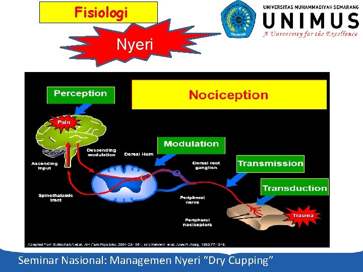 Fisiologi Nyeri Seminar Nasional: Managemen Nyeri “Dry Cupping” 
