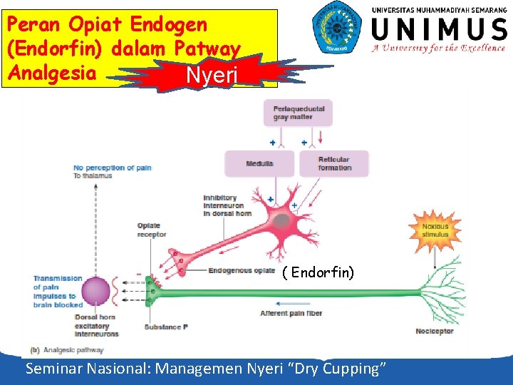 Peran Opiat Endogen (Endorfin) dalam Patway Analgesia Nyeri ( Endorfin) Seminar Nasional: Managemen Nyeri