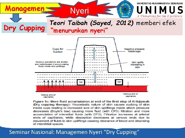 Managemen Nyeri Teori Taibah (Sayed, 2012) memberi efek Dry Cupping “menurunkan nyeri” Seminar Nasional: