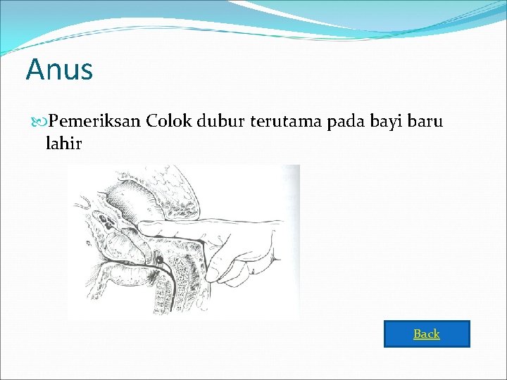 Anus Pemeriksan Colok dubur terutama pada bayi baru lahir Back 