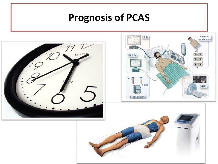 Prognosis of PCAS 